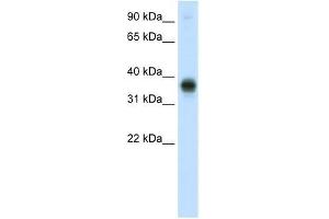 E2F3 antibody used at 0. (E2F3 antibody  (C-Term))