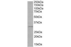 Image no. 1 for anti-Toll-Interleukin 1 Receptor (TIR) Domain Containing Adaptor Protein (TIRAP) (C-Term) antibody (ABIN374117) (TIRAP antibody  (C-Term))