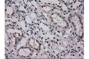 Immunohistochemical staining of paraffin-embedded Kidney tissue using anti-NRBP1mouse monoclonal antibody. (NRBP1 antibody)