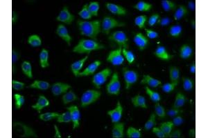 Immunofluorescence staining of A549 cells with ABIN7173187 at 1:100, counter-stained with DAPI. (TMEM26 antibody  (AA 302-368))