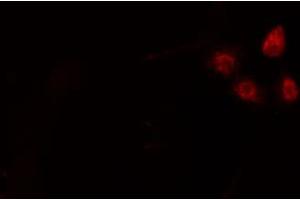 ABIN6274204 staining HepG2 cells by IF/ICC. (NFYA antibody  (C-Term))