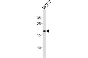 Western Blotting (WB) image for anti-GTPase NRas (NRAS) antibody (ABIN3003468) (GTPase NRas antibody)