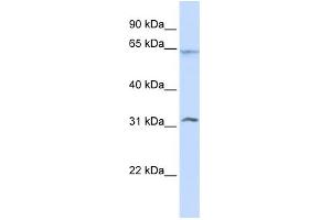 WB Suggested Anti-METT10D Antibody Titration:  0. (METTL16 antibody  (N-Term))