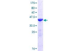 HPCAL1 Protein (AA 1-193) (GST tag)