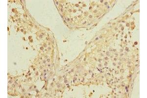 Immunohistochemistry of paraffin-embedded human testis tissue using ABIN7163286 at dilution of 1:100 (PGAM2 antibody  (AA 1-253))