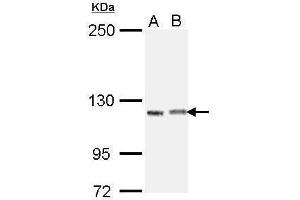 WB Image Sample (30 ug of whole cell lysate) A: H1299 B: Raji 5% SDS PAGE antibody diluted at 1:1000 (IGSF3 antibody)