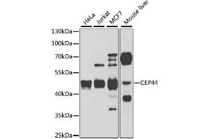 Western blot analysis of extracts of various cell lines, using CEP44 antibody. (CEP44 antibody)