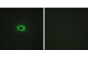 Immunofluorescence analysis of HeLa cells, using TNF12 Antibody. (TWEAK antibody  (AA 41-90))