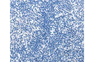 Immunohistochemistry (IHC) image for anti-MutS Homolog 6 (E. Coli) (MSH6) antibody (ABIN1873754) (MSH6 antibody)