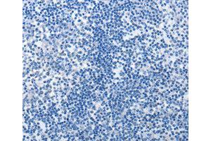 Immunohistochemistry (IHC) image for anti-MutS Homolog 6 (E. Coli) (MSH6) antibody (ABIN1873754) (MSH6 antibody)