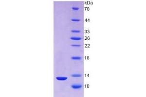 SDS-PAGE (SDS) image for Thioredoxin (TXN) ELISA Kit (ABIN6574192)
