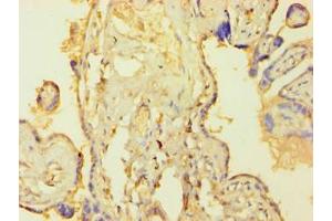 Immunohistochemistry of paraffin-embedded human placenta tissue using ABIN7172759 at dilution of 1:100 (TEAD4 antibody  (AA 74-434))