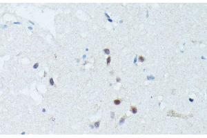 Immunohistochemistry of paraffin-embedded Human brain using MEF2C Polyclonal Antibody at dilution of 1:100 (40x lens). (MEF2C antibody)