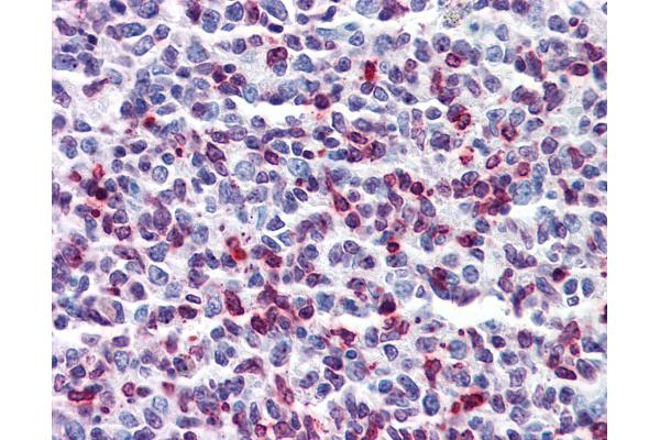 DENND1B antibody  (AA 108-157)