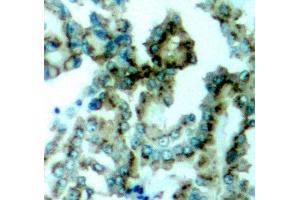 Immunohistochemistry (IHC) image for anti-Protein Kinase C, beta (PRKCB) (pThr641) antibody (ABIN1870521) (PKC beta antibody  (pThr641))