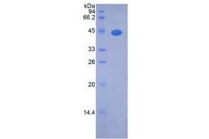 SDS-PAGE analysis of Rat Noggin Protein.