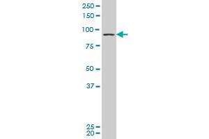 DLG4 polyclonal antibody (A01), Lot # 051108JC01 Western Blot analysis of DLG4 expression in Y-79 . (DLG4 antibody  (AA 665-766))