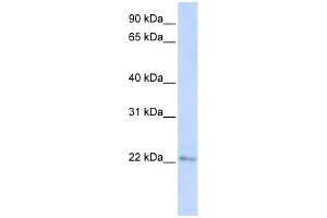 WB Suggested Anti-C6orf64 Antibody Titration:  0.