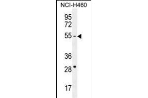 CD2BP2 Antibody (N-term) (ABIN654903 and ABIN2844551) western blot analysis in NCI- cell line lysates (35 μg/lane). (CD2BP2 antibody  (N-Term))