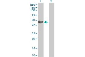 Western Blot analysis of PELO expression in transfected 293T cell line by PELO monoclonal antibody (M03), clone 2C2. (PELO antibody  (AA 291-385))