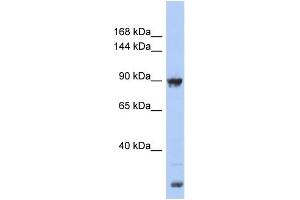 WB Suggested Anti-URG4 Antibody Titration: 0. (URGCP antibody  (Middle Region))
