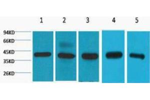Western Blotting (WB) image for anti-Eukaryotic Translation Initiation Factor 4A1 (EIF4A1) antibody (ABIN3178689) (EIF4A1 antibody)