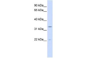 INMT antibody used at 1 ug/ml to detect target protein. (INMT antibody  (N-Term))