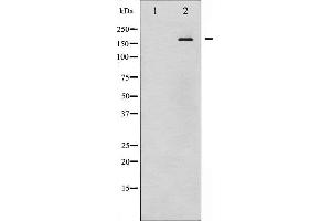 Western blot analysis of EGFR phosphorylation expression in EGF treated HuvEc whole cell lysates,The lane on the left is treated with the antigen-specific peptide. (EGFR antibody  (pTyr1097))