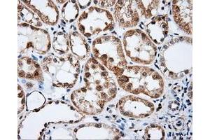 Immunohistochemistry (IHC) image for anti-Bruton Agammaglobulinemia tyrosine Kinase (BTK) antibody (ABIN1496972) (BTK antibody)