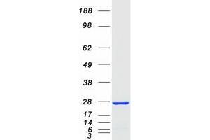 Validation with Western Blot (RAB13 Protein (Myc-DYKDDDDK Tag))