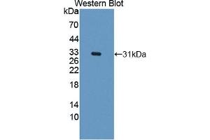 Detection of Recombinant CARD9, Human using Polyclonal Antibody to Caspase Recruitment Domain Family, Member 9 (CARD9) (CARD9 antibody  (AA 26-283))