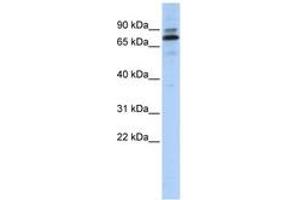Image no. 1 for anti-Chromosome 14 Open Reading Frame 21 (C14orf21) (AA 215-264) antibody (ABIN6740714) (C14orf21 antibody  (AA 215-264))