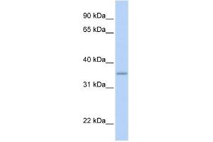 GRHPR antibody used at 1 ug/ml to detect target protein. (GRHPR antibody  (N-Term))