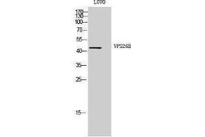 Western Blotting (WB) image for anti-Vacuolar Protein Sorting 26 Homolog B (VPS26B) (Internal Region) antibody (ABIN3177931) (VPS26B antibody  (Internal Region))