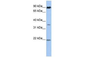 C13ORF7 antibody used at 1 ug/ml to detect target protein. (RNF219 antibody  (N-Term))