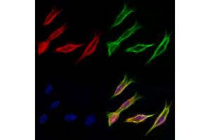 ABIN6259797 and ABIN6277038 staining Hela cells by IF/ICC. (ADH5 antibody  (C-Term))