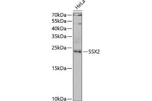 Western blot analysis of extracts of HeLa cells, using SSX2 antibody (ABIN6128794, ABIN6148505, ABIN6148507 and ABIN6222753) at 1:1000 dilution. (SSX2 antibody  (AA 1-188))