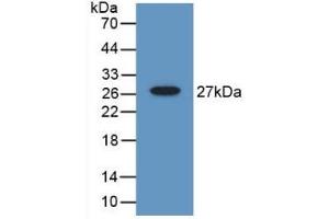 Detection of Recombinant Gelsolin, Mouse using Polyclonal Antibody to Gelsolin (GSN) (Gelsolin antibody  (AA 432-625))