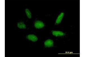 Immunofluorescence of purified MaxPab antibody to RAPGEF5 on HepG2 cell. (GFR antibody  (AA 1-444))