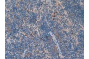DAB staining on IHC-P; Samples: Rat Spleen Tissue (GDF3 antibody  (AA 253-366))