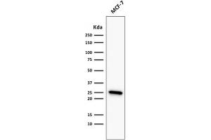 ABIN6383839 to BCL2 was successfully used to stain an approx. (Recombinant Bcl-2 antibody)