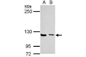 WB Image Sample (30 ug of whole cell lysate) A: Jurkat B: K562 5% SDS PAGE antibody diluted at 1:1000 (UNC13D antibody  (C-Term))