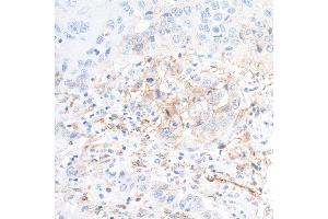Immunohistochemistry (IHC) image for anti-5'-Nucleotidase, Ecto (CD73) (NT5E) (AA 27-552) antibody (ABIN7449540) (Recombinant CD73 antibody  (AA 27-552))
