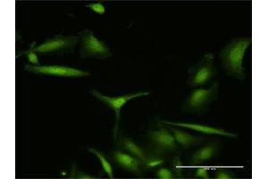 Immunofluorescence of purified MaxPab antibody to S100A7 on HeLa cell. (S100A7 antibody  (AA 1-101))