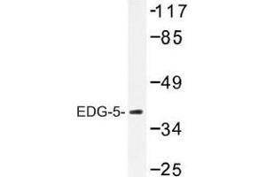 Image no. 1 for anti-Sphingosine-1-Phosphate Receptor 2 (S1PR2) antibody (ABIN317746) (S1PR2 antibody)