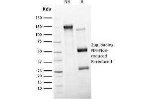 SDS-PAGE Analysis Purified CD11c Mouse Monoclonal Antibody (ITGAX/2507). (CD11c antibody  (AA 637-827))