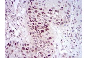 Immunohistochemistry (IHC) image for anti-Histone Deacetylase 10 (HDAC10) (AA 18-219) antibody (ABIN5542323)