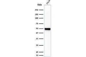 Western Blot Analysis of HeLa cell lysate using Fascin-1 Mouse Monoclonal Antibody (FSCN1/416). (Fascin antibody)