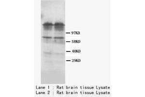 Image no. 1 for anti-Dopamine Receptor D1 (DRD1) (C-Term) antibody (ABIN1493058) (Dopamine Receptor d1 antibody  (C-Term))