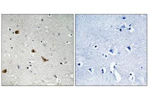 Immunohistochemistry (IHC) image for anti-Inhibitor of kappa Light Polypeptide Gene Enhancer in B-Cells, Kinase gamma (IKBKG) (pSer376) antibody (ABIN7138585)